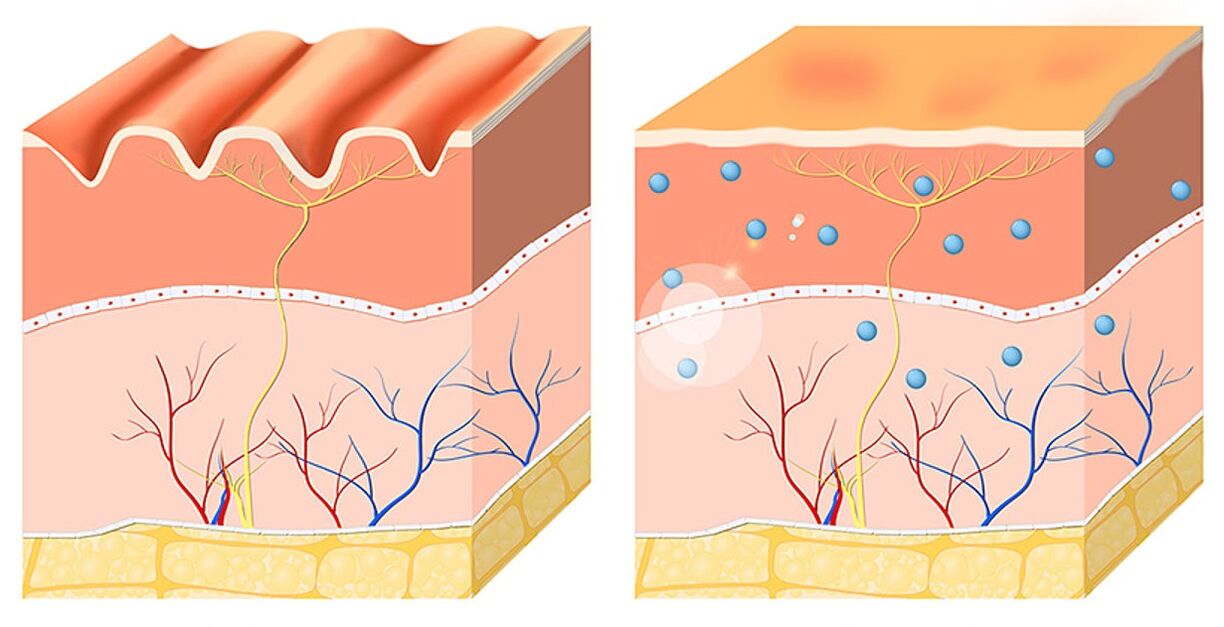 Inno Gialuron evens and hydrates the epidermis