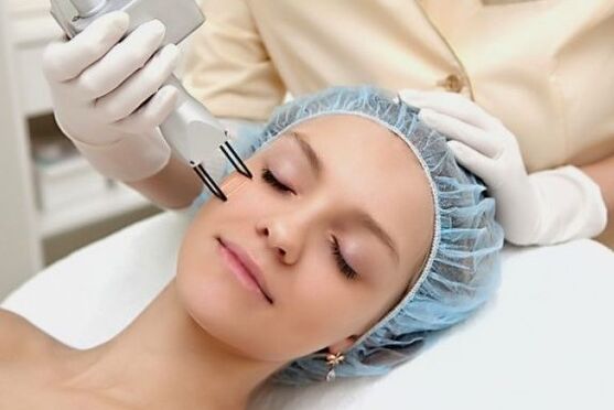 Laser rejuvenation