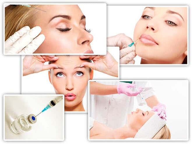 Facial rejuvenation injections