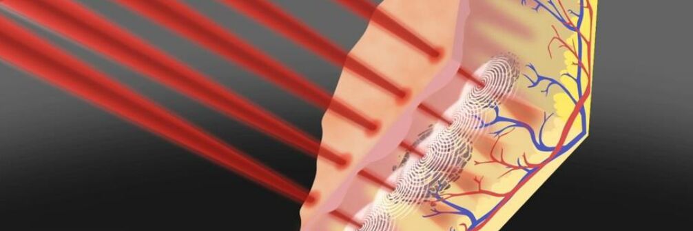Skin field rejuvenation