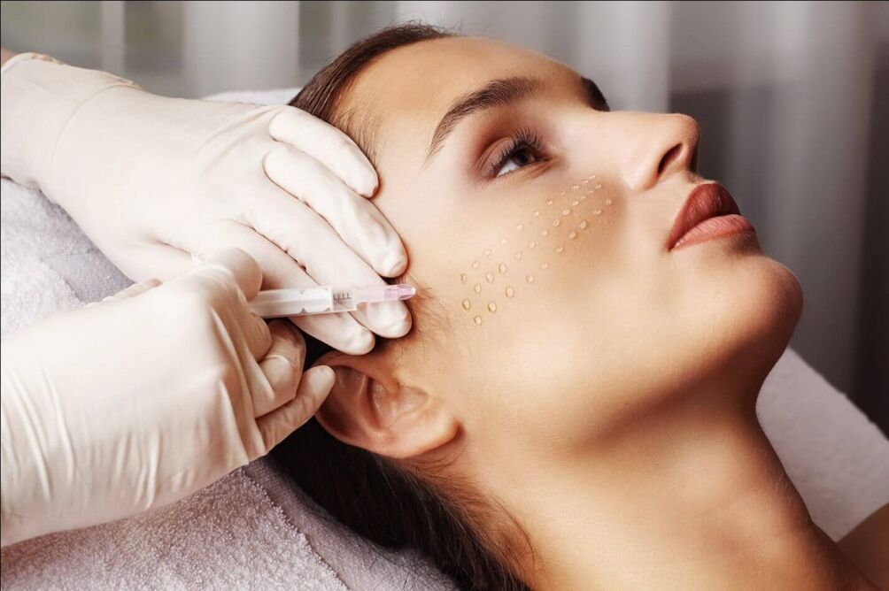 Injection rejuvenation