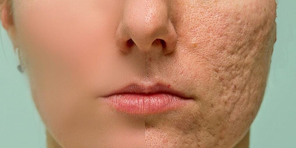 Indications for the rejuvenation procedure