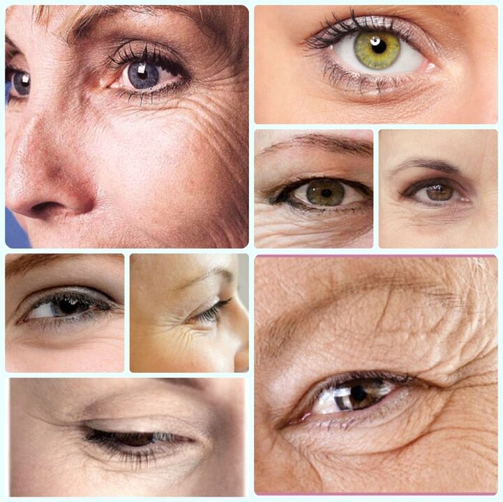 Skin rejuvenation