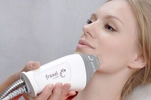 the essence of the fractional facial skin rejuvenation procedure