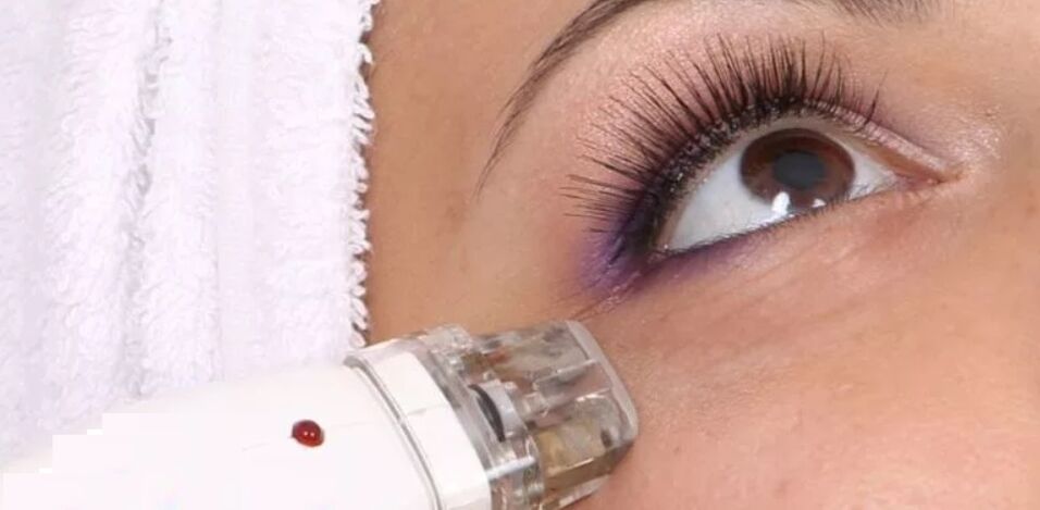 Rejuvenation technique using high temperature.