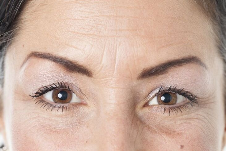 causes of facial skin aging